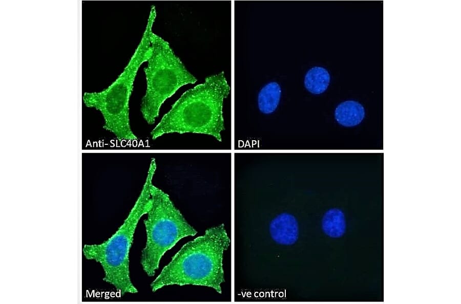 Immunofluorescence - Anti-SLC40A1 Antibody (A85120) - Antibodies.com