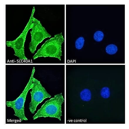 Immunofluorescence - Anti-SLC40A1 Antibody (A85120) - Antibodies.com