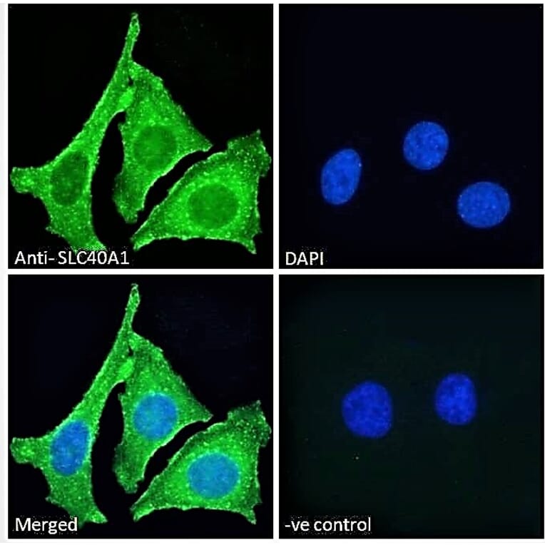 Immunofluorescence - Anti-SLC40A1 Antibody (A85120) - Antibodies.com
