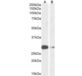 Western Blot - Anti-MASH1/Achaete-Scute Homolog 1 Antibody (A85121) - Antibodies.com