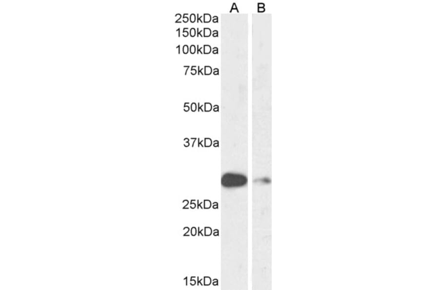 Western Blot - Anti-MASH1/Achaete-Scute Homolog 1 Antibody (A85121) - Antibodies.com