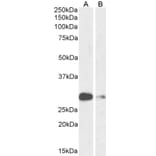 Western Blot - Anti-MASH1/Achaete-Scute Homolog 1 Antibody (A85121) - Antibodies.com