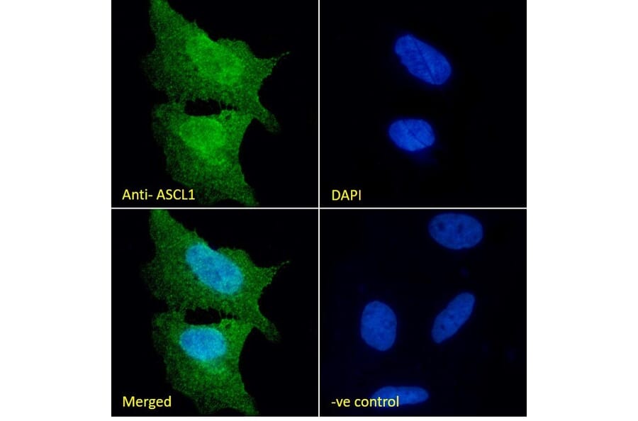 Immunofluorescence - Anti-MASH1/Achaete-Scute Homolog 1 Antibody (A85121) - Antibodies.com