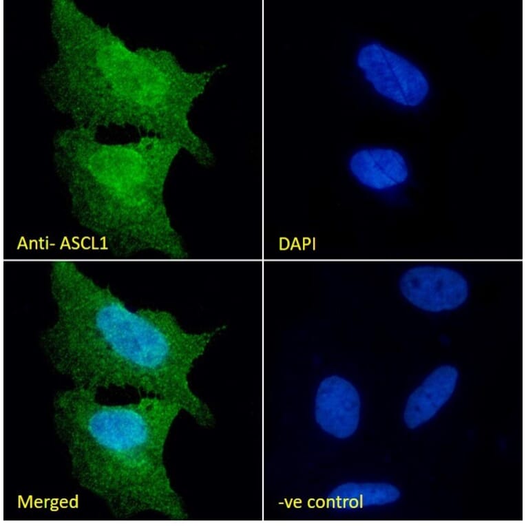 Immunofluorescence - Anti-MASH1/Achaete-Scute Homolog 1 Antibody (A85121) - Antibodies.com