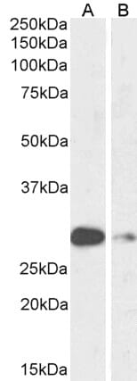 Anti-ASCL1 Antibody (A85121) (1µg/ml) staining of Mouse (A) and Rat (B) Lung lysate (35µg protein in RIPA buffer). Primary incubation was 1 hour. Detected by chemiluminescence