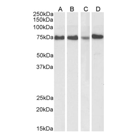 Western Blot - Anti-ATF6 Antibody (A85123) - Antibodies.com