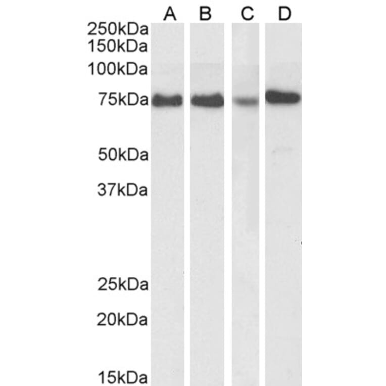 Western Blot - Anti-ATF6 Antibody (A85123) - Antibodies.com