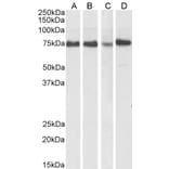 Western Blot - Anti-ATF6 Antibody (A85123) - Antibodies.com