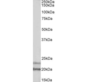 Western Blot - Anti-IL-17D Antibody (A85124) - Antibodies.com