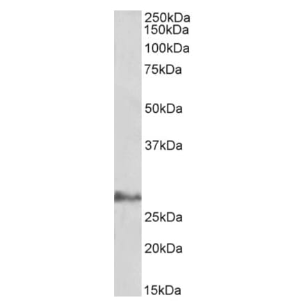 Western Blot - Anti-IL-17D Antibody (A85125) - Antibodies.com