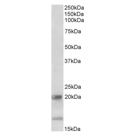 Western Blot - Anti-IL-17B Antibody (A85126) - Antibodies.com