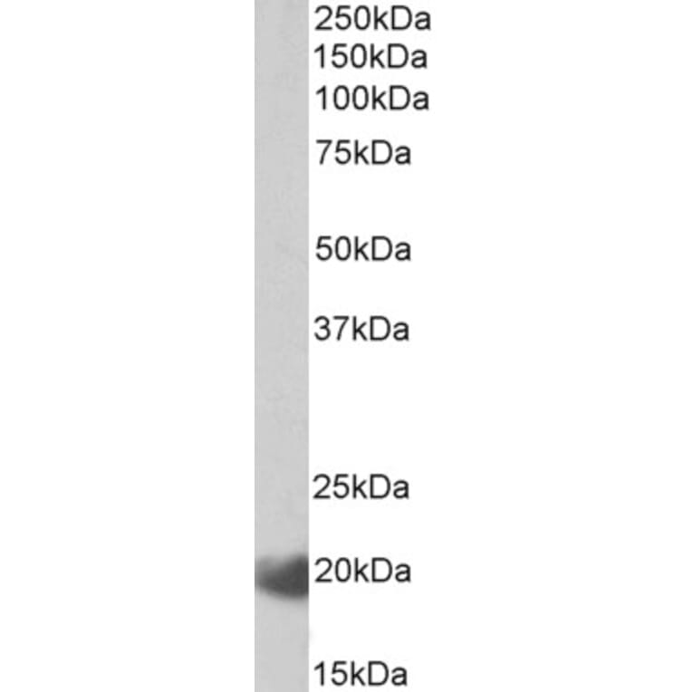 Western Blot - Anti-IL-17C Antibody (A85127) - Antibodies.com