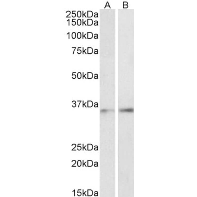 Western Blot - Anti-CEBP beta Antibody (A85133) - Antibodies.com