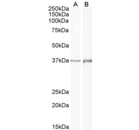 Western Blot - Anti-Dlx2 Antibody (A85134) - Antibodies.com