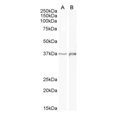 Western Blot - Anti-Dlx2 Antibody (A85134) - Antibodies.com