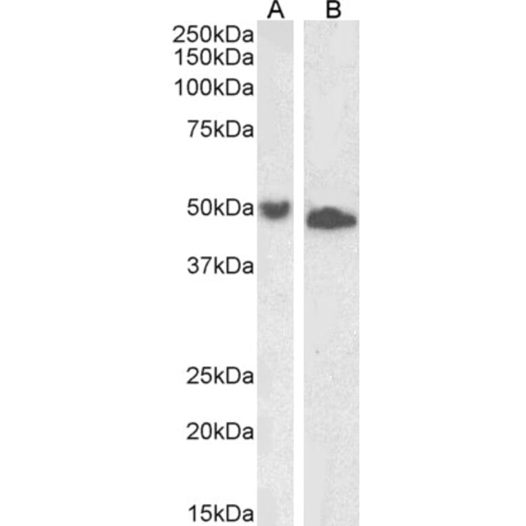 Western Blot - Anti-DPF2/REQ Antibody (A85135) - Antibodies.com