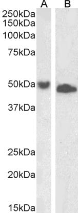 Anti-DPF2 Antibody (A85135) (1µg/ml) staining of Jurkat (A) and K562 (B) lysate (35µg protein in RIPA buffer). Primary incubation was 1 hour. Detected by chemiluminescence.