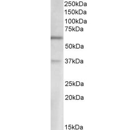 Western Blot - Anti-SLC17A6 Antibody (A85137) - Antibodies.com