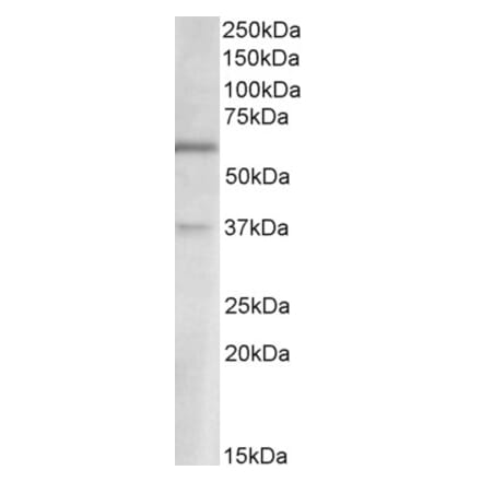 Western Blot - Anti-SLC17A6 Antibody (A85137) - Antibodies.com