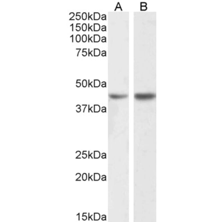 Western Blot - Anti-NPHS2 Antibody (A85139) - Antibodies.com
