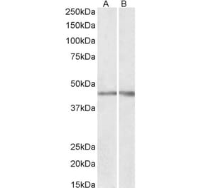 Western Blot - Anti-NPHS2 Antibody (A85139) - Antibodies.com