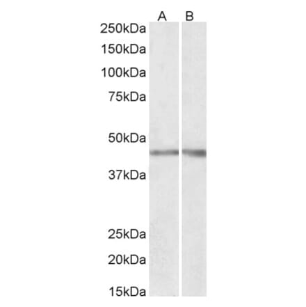 Western Blot - Anti-NPHS2 Antibody (A85139) - Antibodies.com