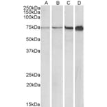 Western Blot - Anti-RPA70 Antibody (A85140) - Antibodies.com