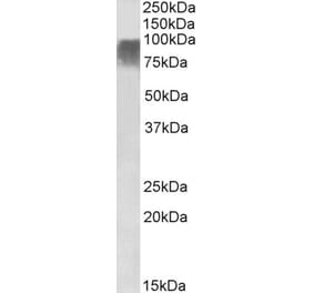 Western Blot - Anti-PRDM9 Antibody (A85141) - Antibodies.com