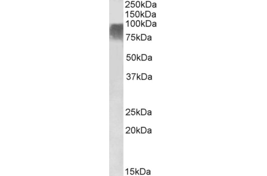 Western Blot - Anti-PRDM9 Antibody (A85141) - Antibodies.com