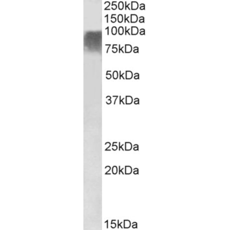 Western Blot - Anti-PRDM9 Antibody (A85141) - Antibodies.com