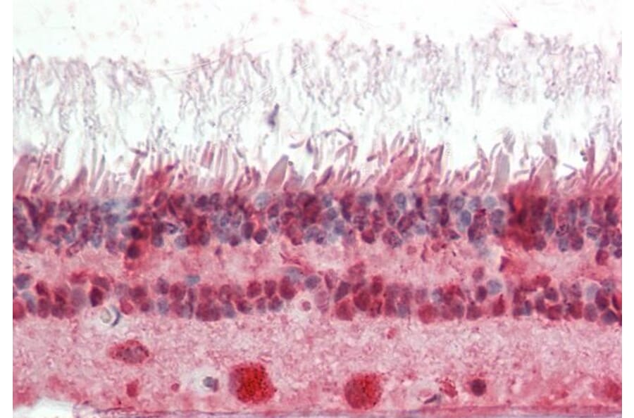 Immunohistochemistry - Anti-CRX Antibody (A85143) - Antibodies.com