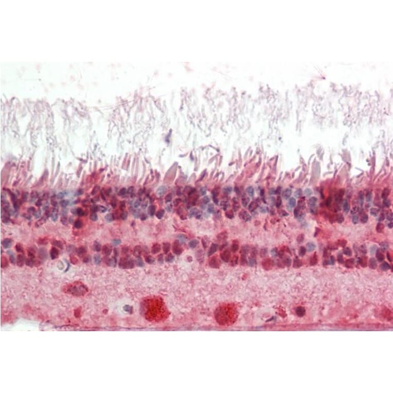 Immunohistochemistry - Anti-CRX Antibody (A85143) - Antibodies.com