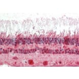 Immunohistochemistry - Anti-CRX Antibody (A85143) - Antibodies.com