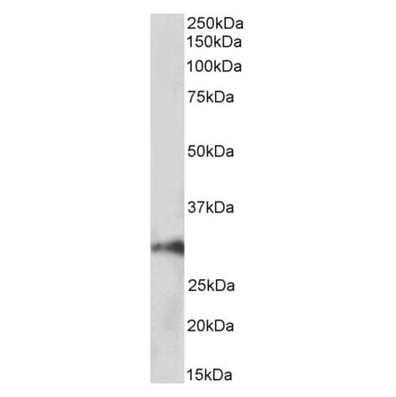 Western Blot - Anti-HOXA5 Antibody (A85147) - Antibodies.com