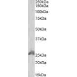 Western Blot - Anti-HOXB6 Antibody (A85148) - Antibodies.com