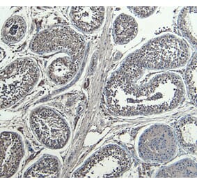 Immunohistochemistry - Anti-HOXA10 Antibody (A85149) - Antibodies.com