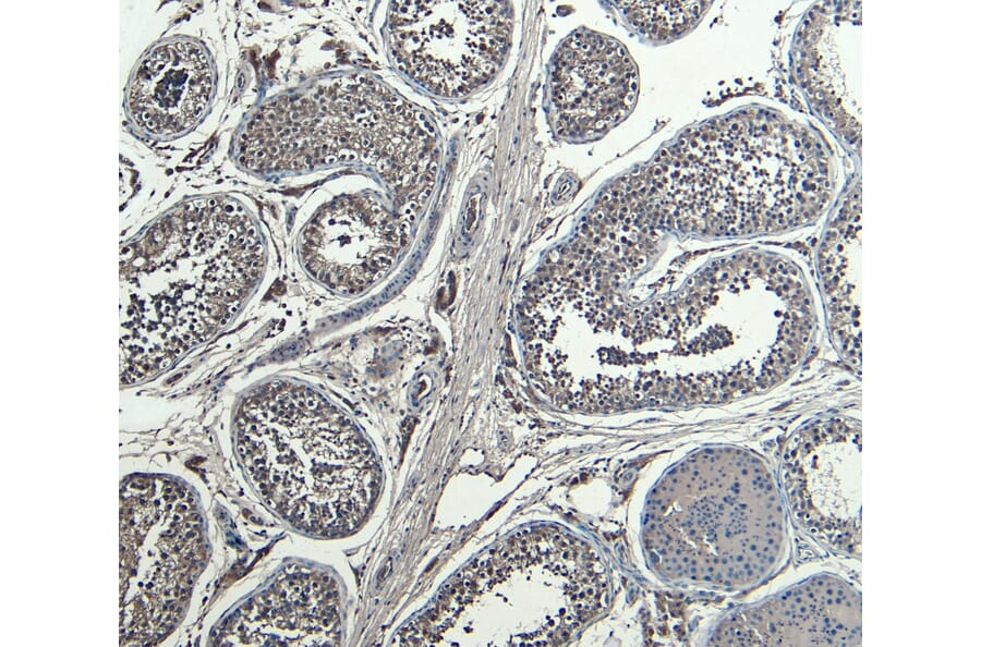 Immunohistochemistry - Anti-HOXA10 Antibody (A85149) - Antibodies.com