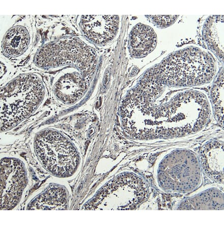 Immunohistochemistry - Anti-HOXA10 Antibody (A85149) - Antibodies.com