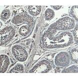 Immunohistochemistry - Anti-HOXA10 Antibody (A85149) - Antibodies.com