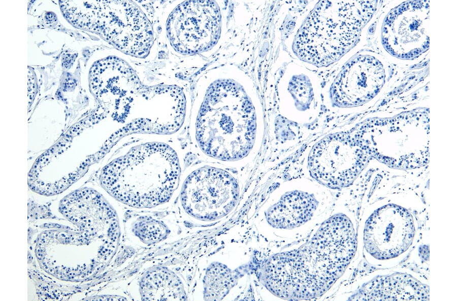Immunohistochemistry - Anti-HOXA10 Antibody (A85149) - Antibodies.com
