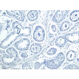 Immunohistochemistry - Anti-HOXA10 Antibody (A85149) - Antibodies.com