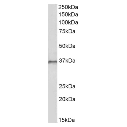 Western Blot - Anti-HOXC10 Antibody (A85151) - Antibodies.com