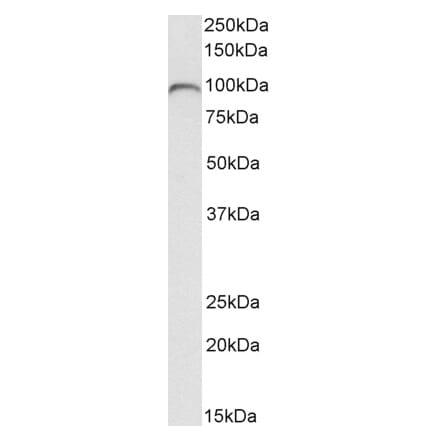 Western Blot - Anti-C7 Antibody (A85152) - Antibodies.com