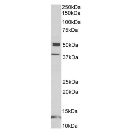 Western Blot - Anti-NP-I Antibody (A85153) - Antibodies.com