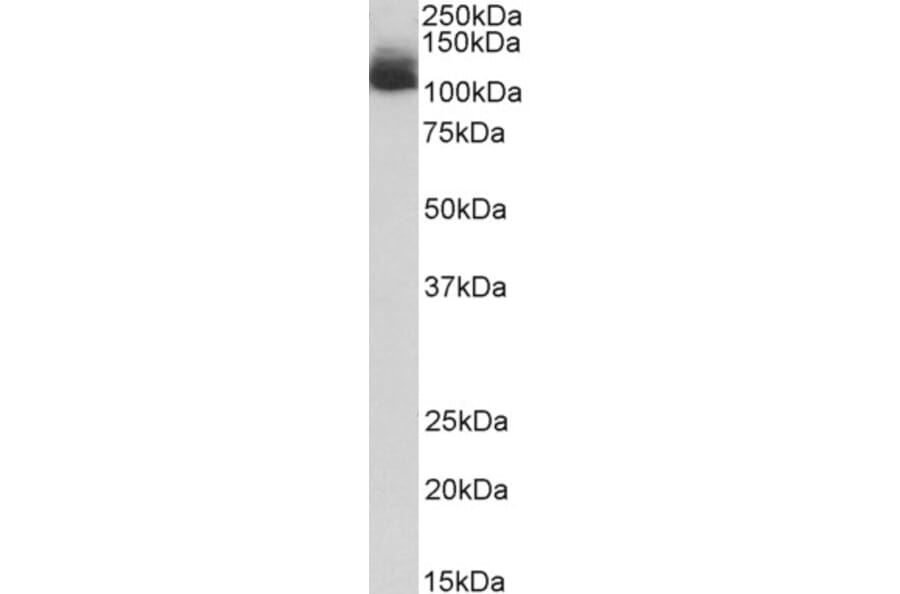 Western Blot - Anti-NALP12/NLRP12 Antibody (A85156) - Antibodies.com