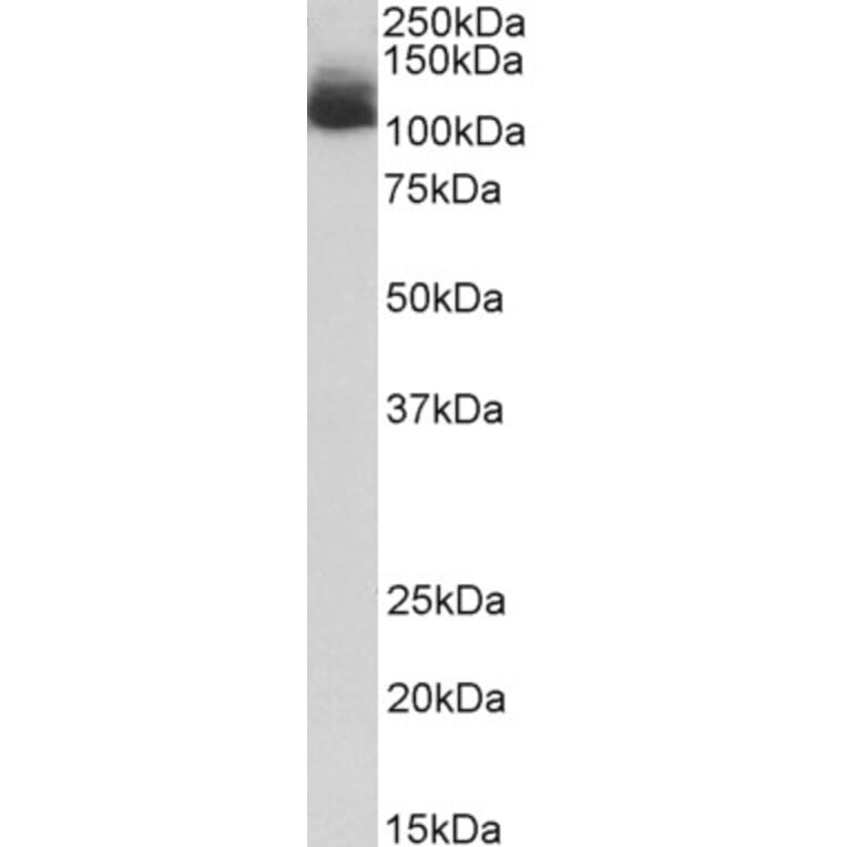 Western Blot - Anti-NALP12/NLRP12 Antibody (A85156) - Antibodies.com