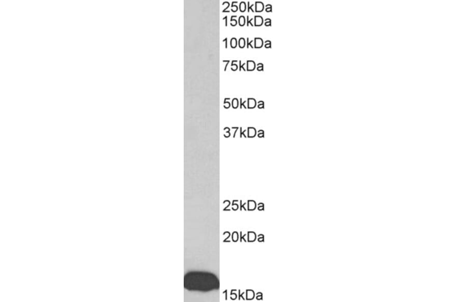 Western Blot - Anti-Prealbumin Antibody (A85160) - Antibodies.com