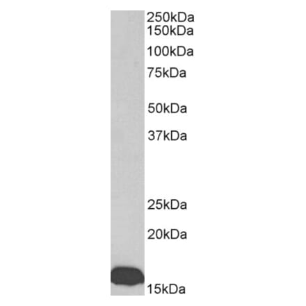 Western Blot - Anti-Prealbumin Antibody (A85160) - Antibodies.com