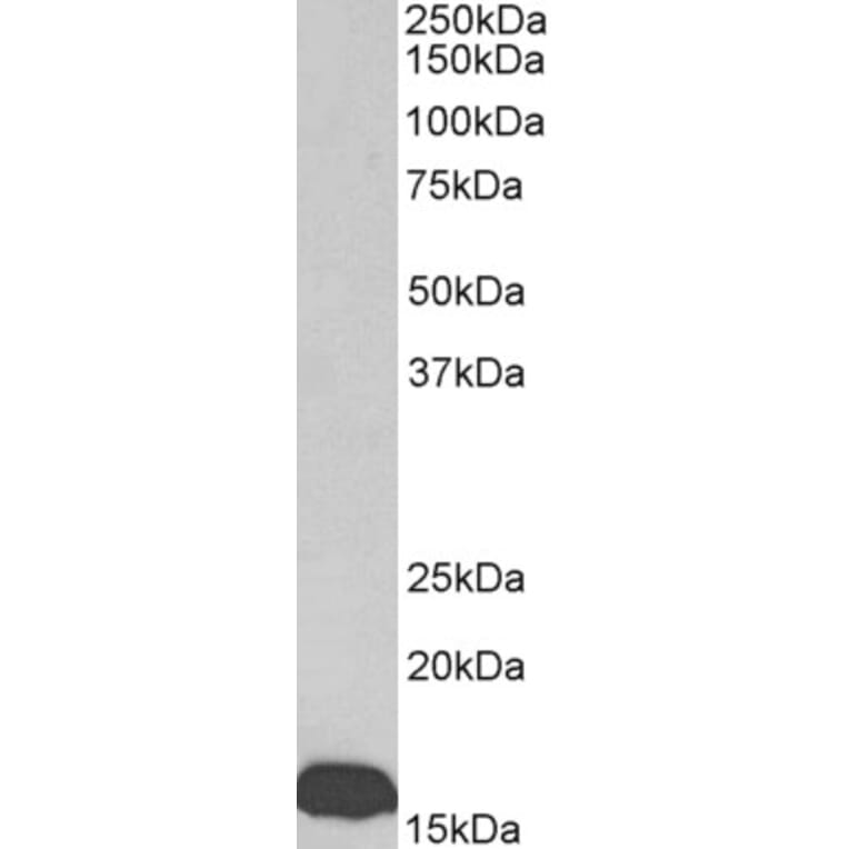 Western Blot - Anti-Prealbumin Antibody (A85160) - Antibodies.com