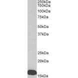 Western Blot - Anti-Prealbumin Antibody (A85160) - Antibodies.com